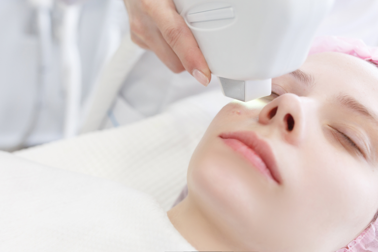 Laser Skin Resurfacing