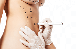 How to choose a surgeon for fat transfer